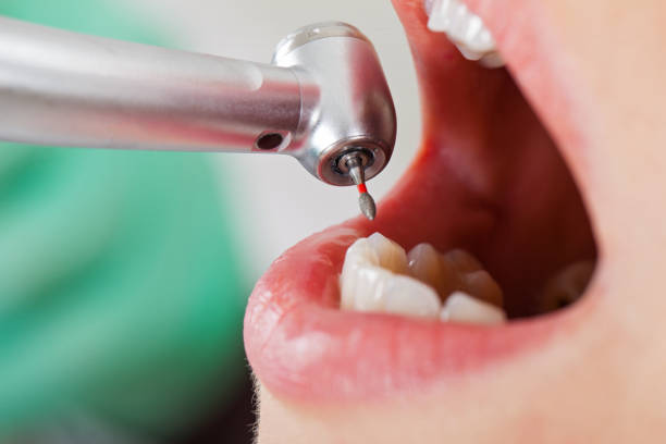 Best After-Hours Dental Trauma Care in Kennesaw State University, GA